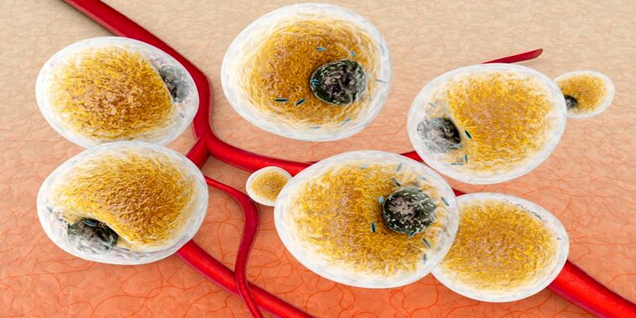 نتایج یک بررسی جدید در درمان چاقی