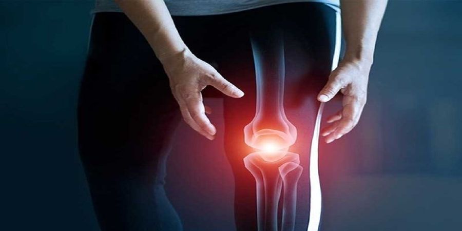  «آرتریت» درمان دارد؟